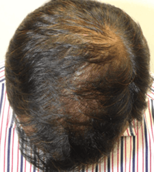 Before treatment