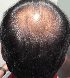 Before treatment