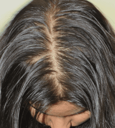 Before treatment