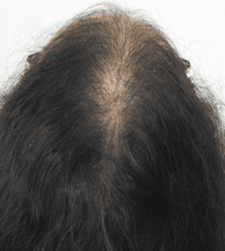 After treatment
