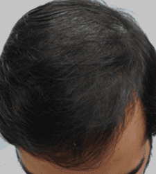 After treatment