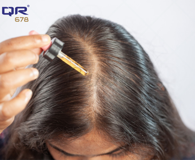 Can Stopping Minoxidil Suddenly Cause Excessive Shedding