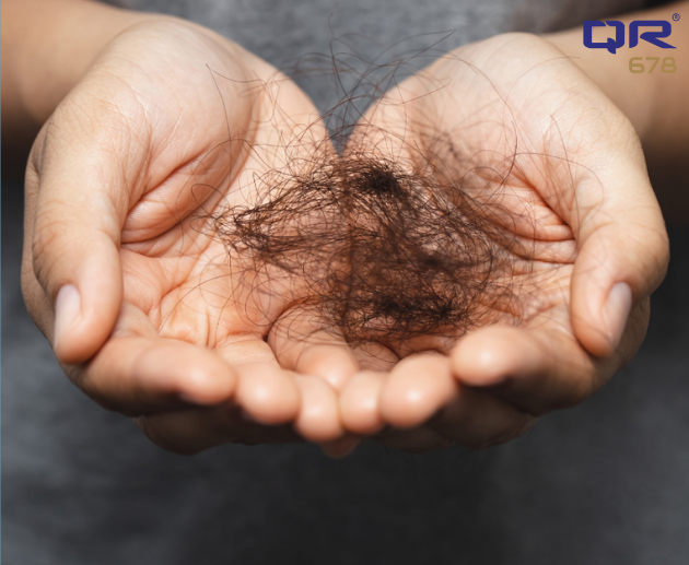 Causes of Hair Thinning in Male & Female