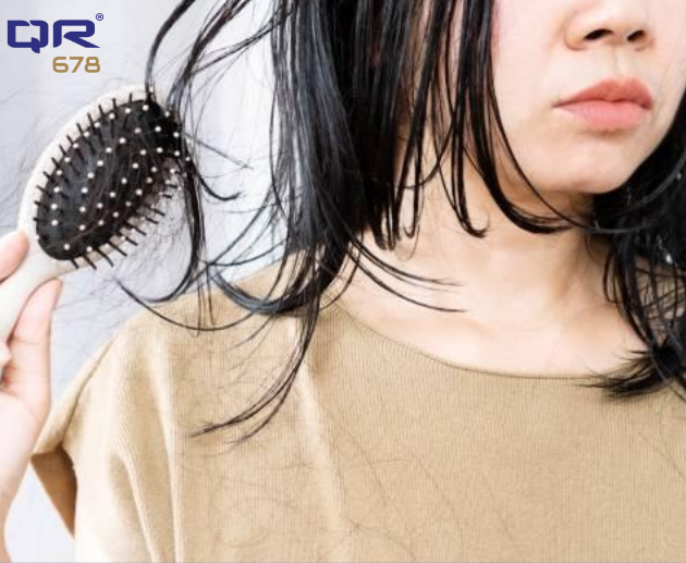 PCOS Cause Hair Loss