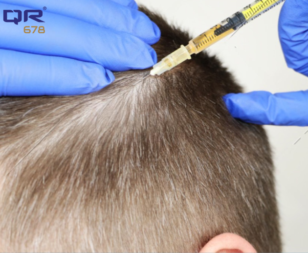 Permanent Hair Fall Solution