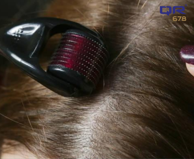 Role of Derma Roller in Reducing Hair Loss