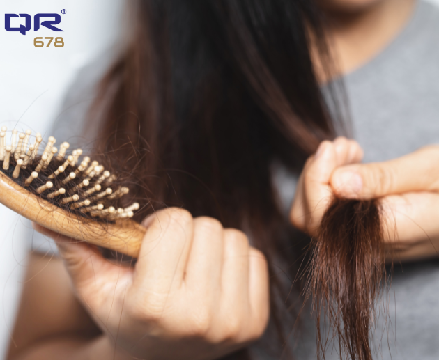 How to Manage Hair Fall Due to Typhoid