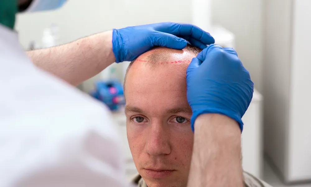 QR678® Is Transforming Hair Treatment in Ahmedabad